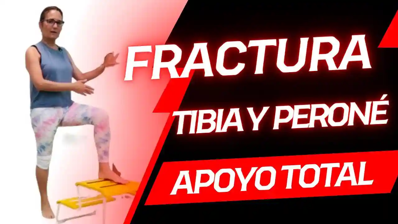 Fractura de Tibia y Peroné: Apoyo Total