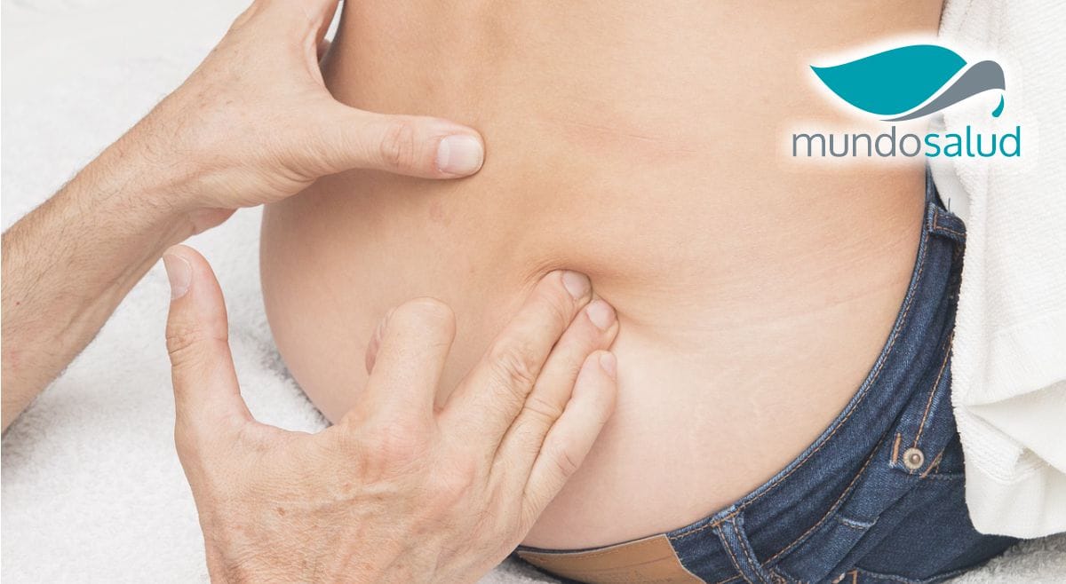 Osteoporosis La Enfermedad Silenciosa